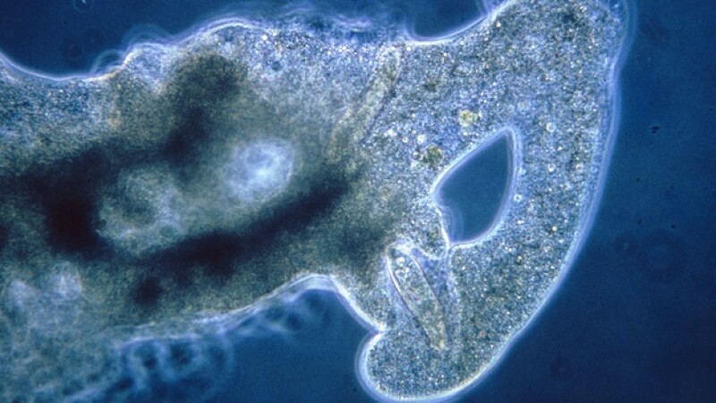 ¿Cómo afectan las infecciones parasitarias a la economía?